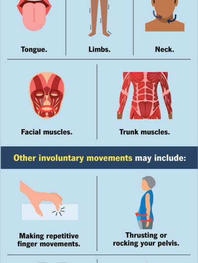 Tardive Dyskinesia and Antipsychotics: Hidden Risks Every Patient Should Understand